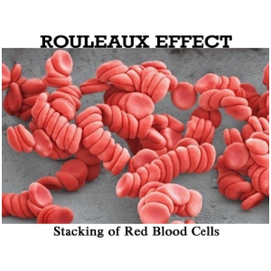 rouleaux effect.jpg